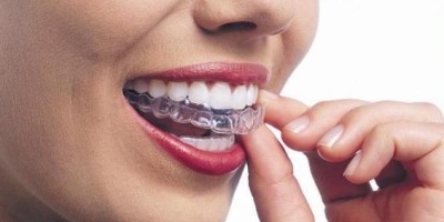 Bite per i denti: stop ai disturbi mandibolari con questo sistema
