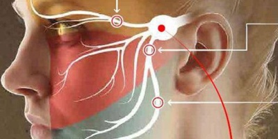 Rialzo del seno mascellare: vediamo insieme di cosa si tratta