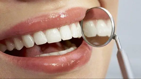 placca dentale