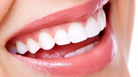 denti bianchi